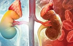 Ghana Advances Healthcare Infrastructure and Maternal Outcomes Amidst Rising Chronic Disease Burden