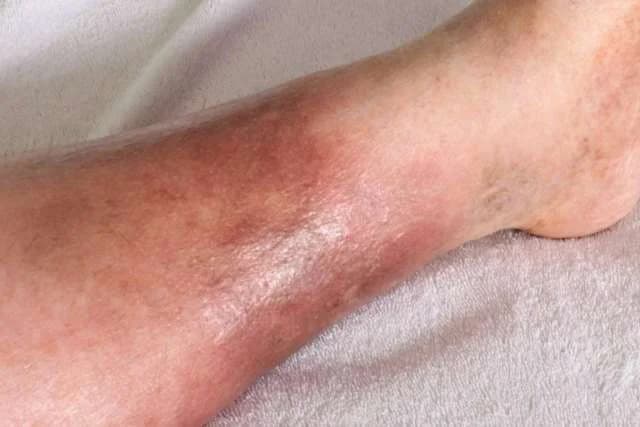 Western Region Reports Fatal Rabies Outbreak as Health Committee Warns Against Risks of Skin Bleaching