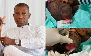 Businessman Kennedy Agyepong 'Kenpong' Hospitalized at Nyaho Medical Centre After Domestic Accident