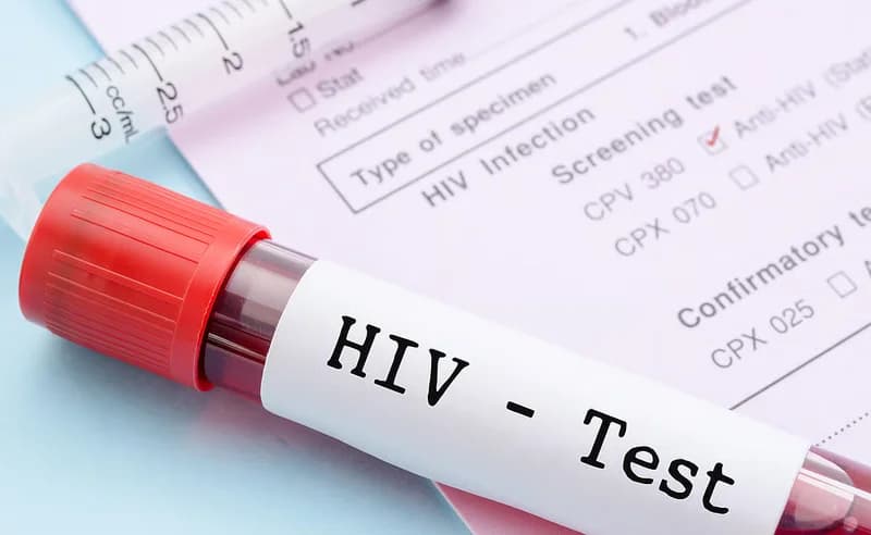 AHF Ghana Warns Persistent HIV Stigma Could Derail 2030 National Health Targets