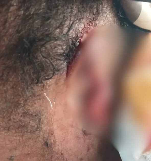 Ashanti Region Woman Arrested for Ear-Biting Assault as Accra Businesswoman Faces Charges for Police Battery and Theft