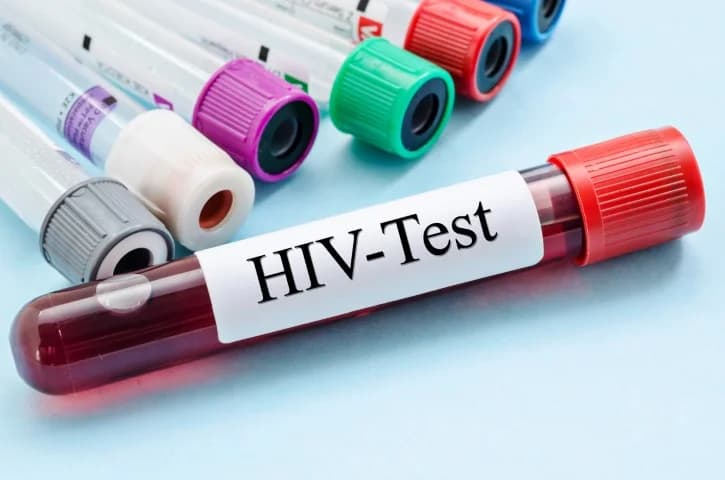 A close-up photograph of several medical blood collection tubes resting on a light blue surface. The primary tube in the foreground is filled with blood and prominently labeled "HIV-Test", while other tubes with different colored caps are visible in the background.