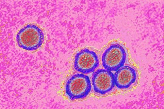 MP Bataglia Calls for Urgent Intervention as Yellow Fever Outbreak Claims Seven Lives in Sissala East