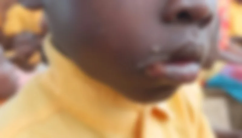 Mafi Kope residents appeal for urgent medical aid for skin infections