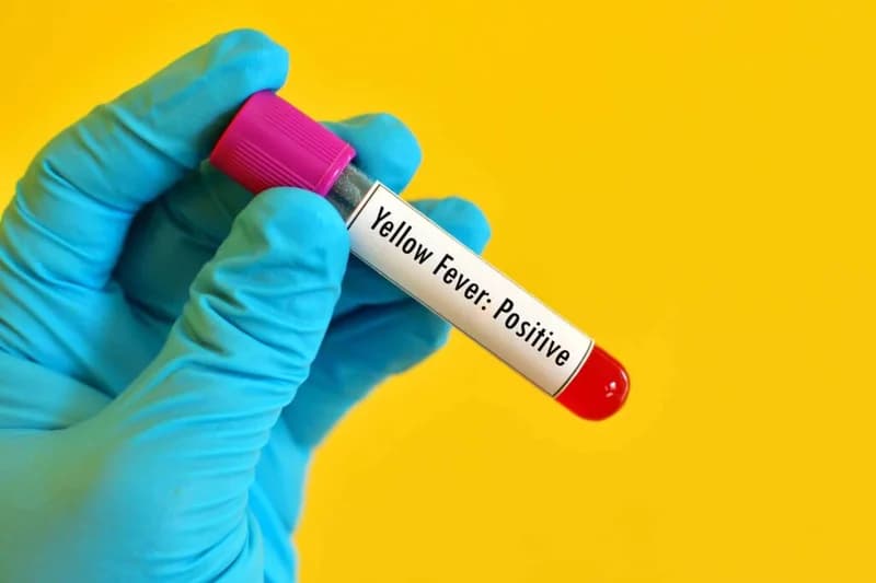 A close-up photograph of a hand in a blue medical glove holding a blood sample tube. The tube features a purple cap and a label clearly stating 'Yellow Fever: Positive' against a vibrant yellow background.