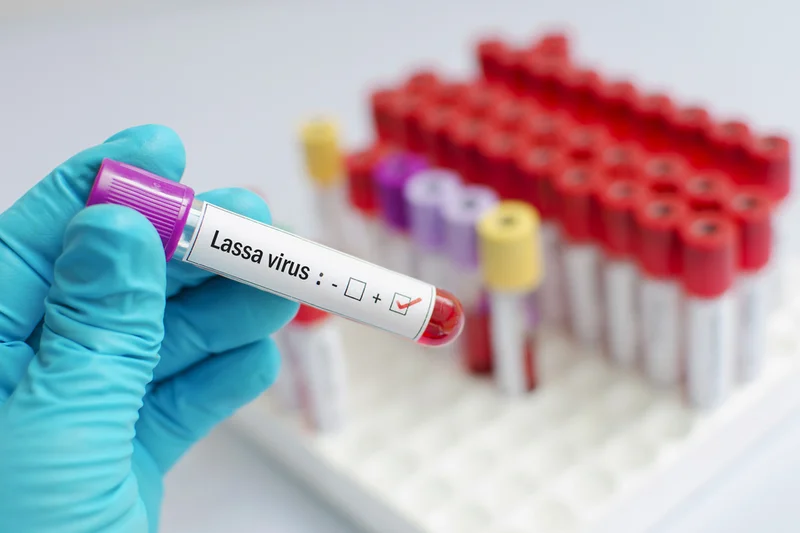 A medical professional wearing blue gloves holds a blood sample tube labeled 'Lassa virus' with a positive checkmark indicated. The background shows a laboratory setting with a rack containing numerous other blood collection tubes with colored caps.